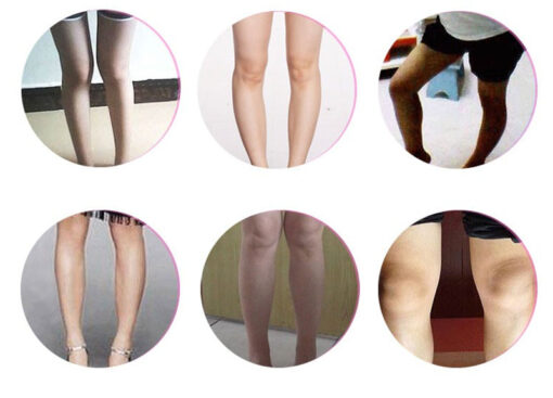 Knee Straightening Belts Bandage - Image 2