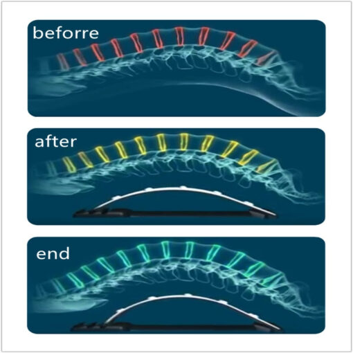 Magnetic Muscle Stretcher Posture Corrector - Image 3